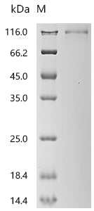 Recombinant Human Leukemia inhibitory factor receptor (LIFR), partial