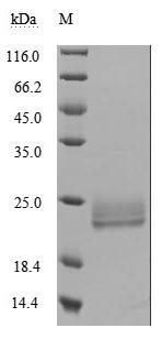 Recombinant Human Lymphotoxin-alpha (LTA) (Active)