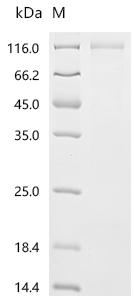 Recombinant Human Microtubule-associated protein tau（MAPT)