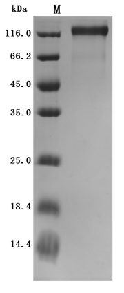 Recombinant Rat Microtubule-associated protein tau (Mapt) (Active)
