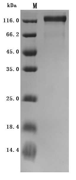 Recombinant Rat Microtubule-associated protein tau (Mapt) (Active)