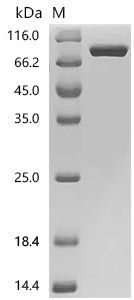 Recombinant Human Melanotransferrin (MELTF) (Active)