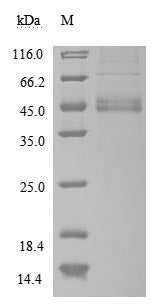 Recombinant Human Macrophage migration inhibitory factor (MIF) (Active)