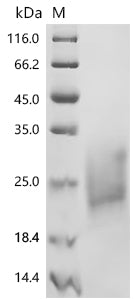 Recombinant Macaca fascicularis Natural cytotoxicity triggering receptor 3 (NCR3), partial (Active)