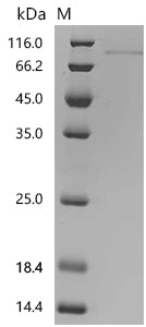 Recombinant Human Netrin-1 (NTN1), partial