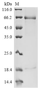 Recombinant Human Proprotein convertase subtilisin/kexin type 9 (PCSK9) (R194A), partial