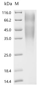 Recombinant Human Receptor-type tyrosine-protein phosphatase alpha (PTPRA), partial
