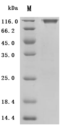 Recombinant Human Proto-oncogene tyrosine-protein kinase receptor Ret (RET), partial (Active)