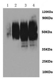 Recombinant Rat Sphingosine 1-phosphate receptor 2 (S1pr2)-VLPs