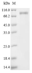Recombinant Human Semenogelin-2 (SEMG2)