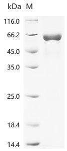 Recombinant Rat Pulmonary surfactant-associated protein A (Sftpa1)