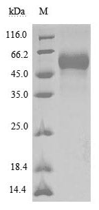 Recombinant Human Tyrosine-protein phosphatase non-receptor type substrate 1 (SIRPA), partial (Active)