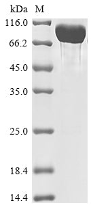 Recombinant Human Tyrosine-protein phosphatase non-receptor type substrate 1 (SIRPA), partial