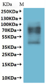 Recombinant Human Somatostatin receptor type 1 (SSTR1)-VLPs