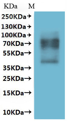 Recombinant Human Somatostatin receptor type 1 (SSTR1)-VLPs