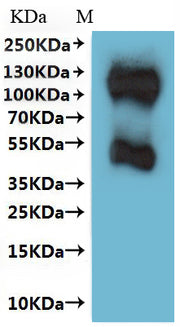 Recombinant Human Somatostatin receptor type 3 (SSTR3)-VLPs