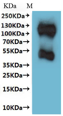 Recombinant Human Somatostatin receptor type 3 (SSTR3)-VLPs