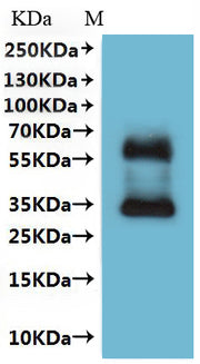 Recombinant Human Somatostatin receptor type 4 (SSTR4)-VLPs