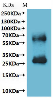Recombinant Human Somatostatin receptor type 5 (SSTR5)-VLPs