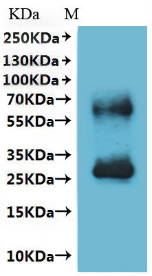 Recombinant Human Somatostatin receptor type 5 (SSTR5)-VLPs