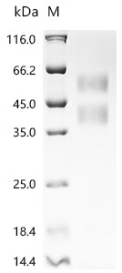 Recombinant Human Transforming growth factor beta-1 proprotein (TGFB1)
