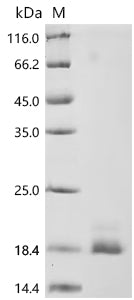 Recombinant Human Tumor necrosis factor receptor superfamily member 10B (TNFRSF10B), partial (Active)