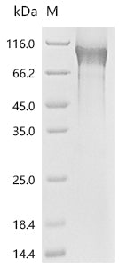 Recombinant Human Tumor necrosis factor receptor superfamily member 8(TNFRSF8), partial