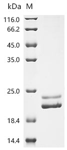 Recombinant Human Tumor necrosis factor ligand superfamily member 9 (TNFSF9), partial