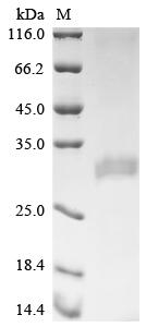 Recombinant Human Translationally-controlled tumor proteinv (SMPD1)