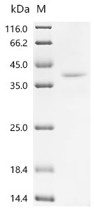 Recombinant Mouse Thyrotropin subunit beta（Tshb), partial