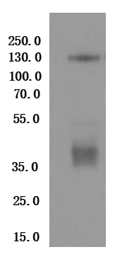 Recombinant Human Thyrotropin receptor (TSHR)-VLPs (Active)