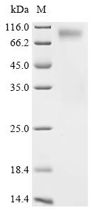 Recombinant Human Zinc finger protein 410 (ZNF410)