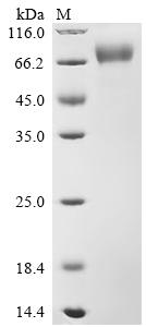 Recombinant Gibbon ape leukemia virus Envelope glycoprotein (env), partial