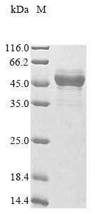 Recombinant Paeniclostridium sordellii Sialidase