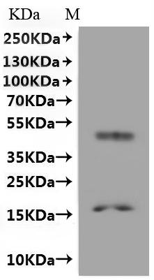 Recombinant Methanobacterium formicicum Probable formate transporter (fdhC)-VLPs