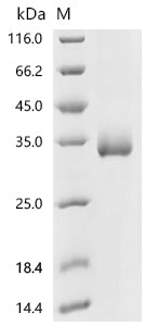 Recombinant Severe acute respiratory syndrome coronavirus 2 Spike glycoprotein (S) (E484K,N501Y), partial