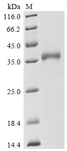 Recombinant Severe acute respiratory syndrome coronavirus 2 Spike glycoprotein (S), partial, Biotinylated