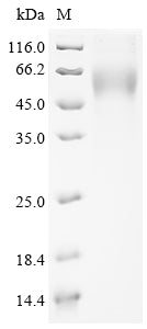 Recombinant Severe acute respiratory syndrome coronavirus 2 Spike glycoprotein (S) (G75V,T76I,SYLTPGD247-253del), partial