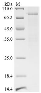 Recombinant Metamycoplasma hominis Arginine deiminase (arcA) (P210S)