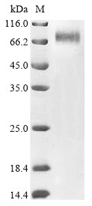 Recombinant Human adenovirus C serotype 5 Hexon protein (L3) (T273A), partial