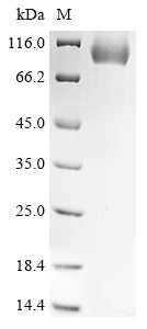 Recombinant Mouse Serine protease inhibitor A3K
 (Serpina3k)