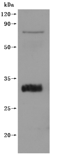 Recombinant Macaca fascicularis Claudin 18.2 (CLDN18.2)-VLPs (Active)
