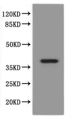 Recombinant Xenopus laevis paqr8.L&abhd2.S Heterodimer Protein-VLPs