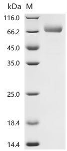 Recombinant Human MHC Class I chain-related protein (MICA), partial (Active)