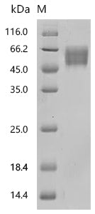 Recombinant Human MHC Class I chain-related protein (MICA), partial (Active)