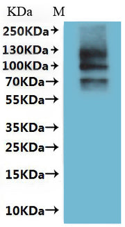 Recombinant Dog Transient receptor potential cation channel subfamily V member 6 (TRPV6)-VLPs