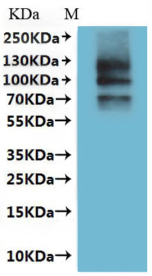 Recombinant Dog Transient receptor potential cation channel subfamily V member 6 (TRPV6)-VLPs