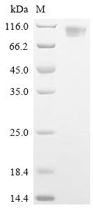 Recombinant Porcine epidemic diarrhea virus Spike glycoprotein(S), partial