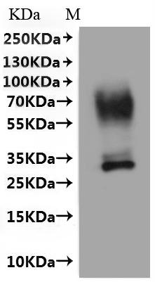Recombinant Human Urea transporter 1 (SLC14A1)-VLPs