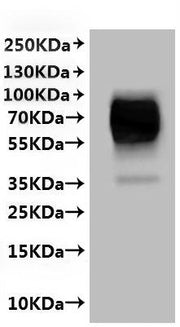 Recombinant Human Hepatic sodium/bile acid cotransporter (SLC10A1)-VLPs